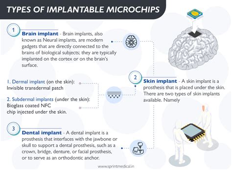 rfid chip update|Microchips in humans: consumer.